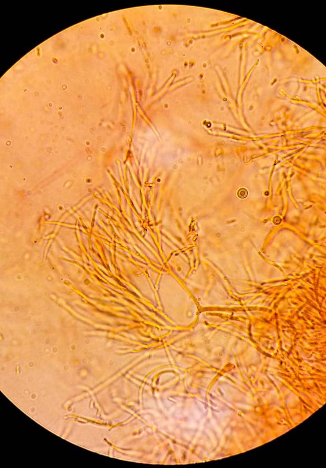 Coryne dubia image