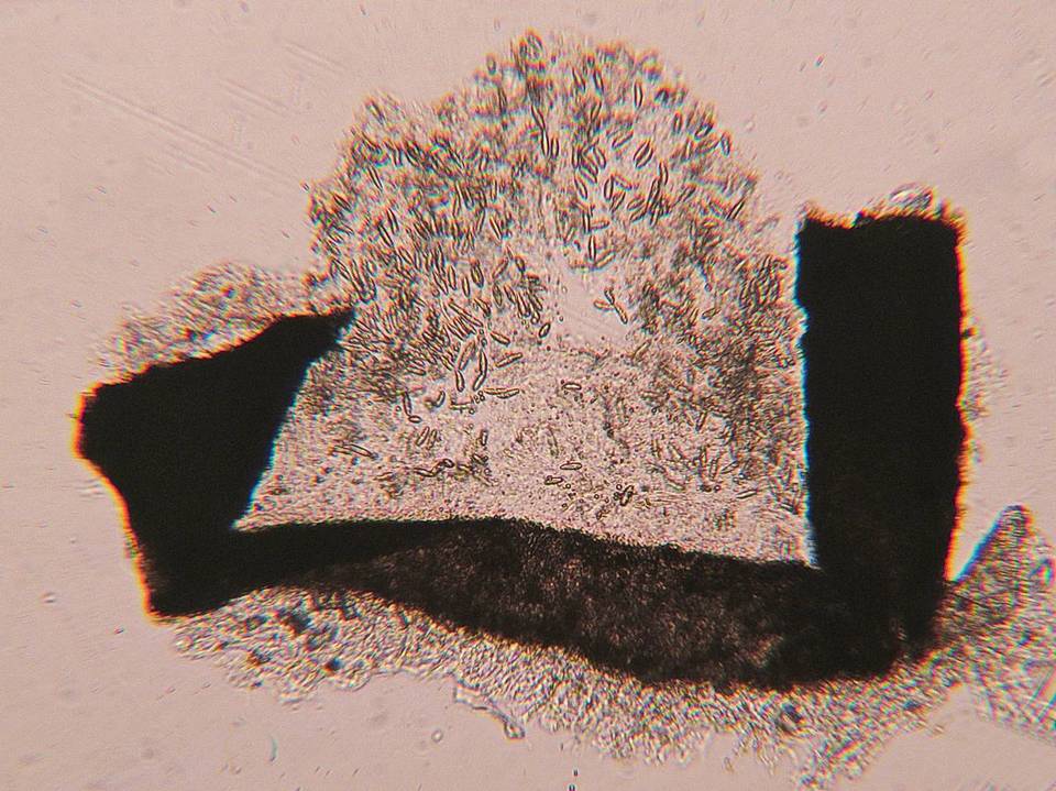 Coccomyces gaultheriae image