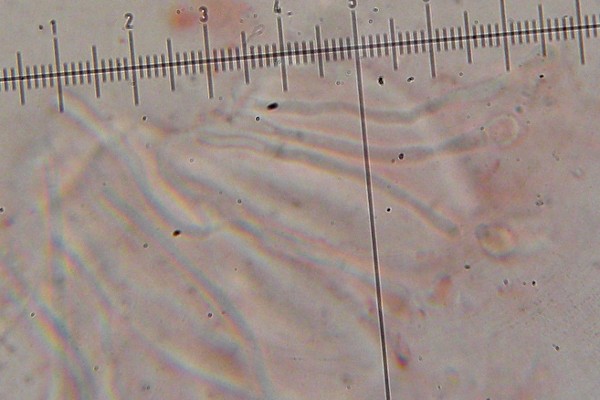 Caloplaca tiroliensis image