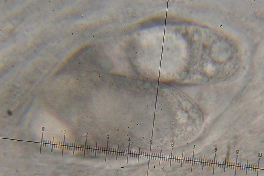 Ochrolechia szatalaensis image