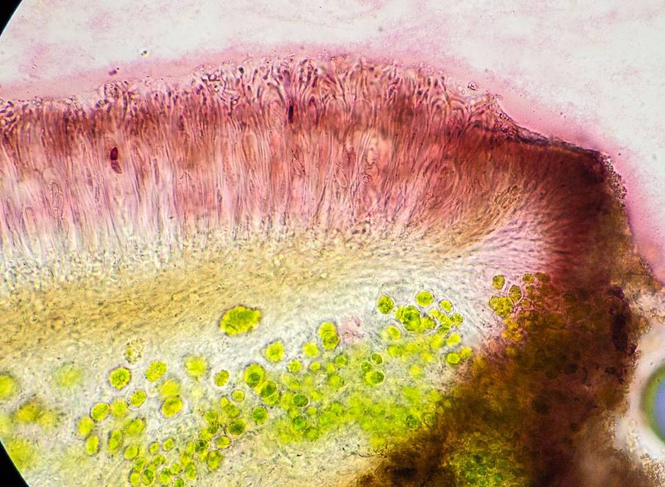Caloplaca nivalis image