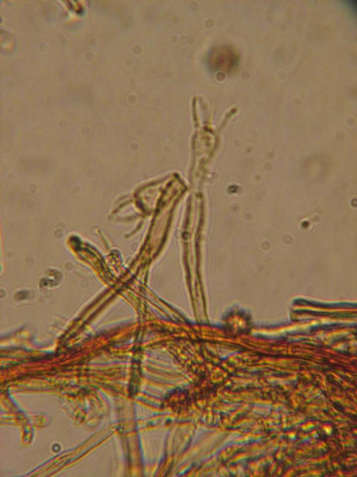 Tomentella fibrosa image