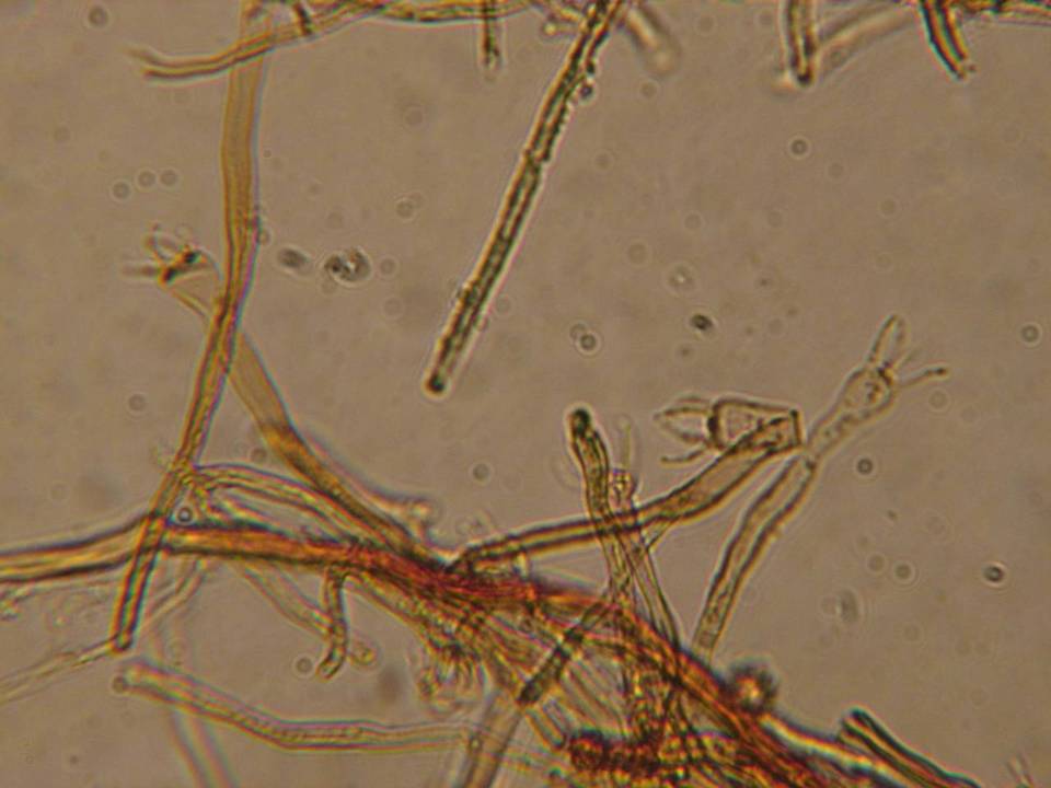 Tomentella fibrosa image