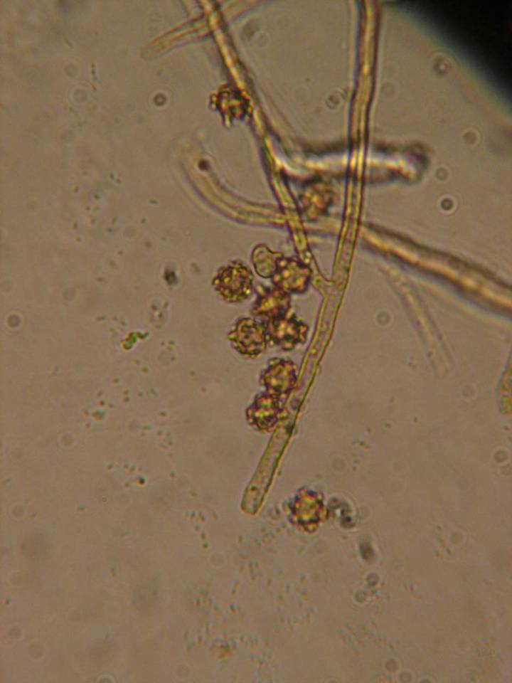 Tomentella fibrosa image
