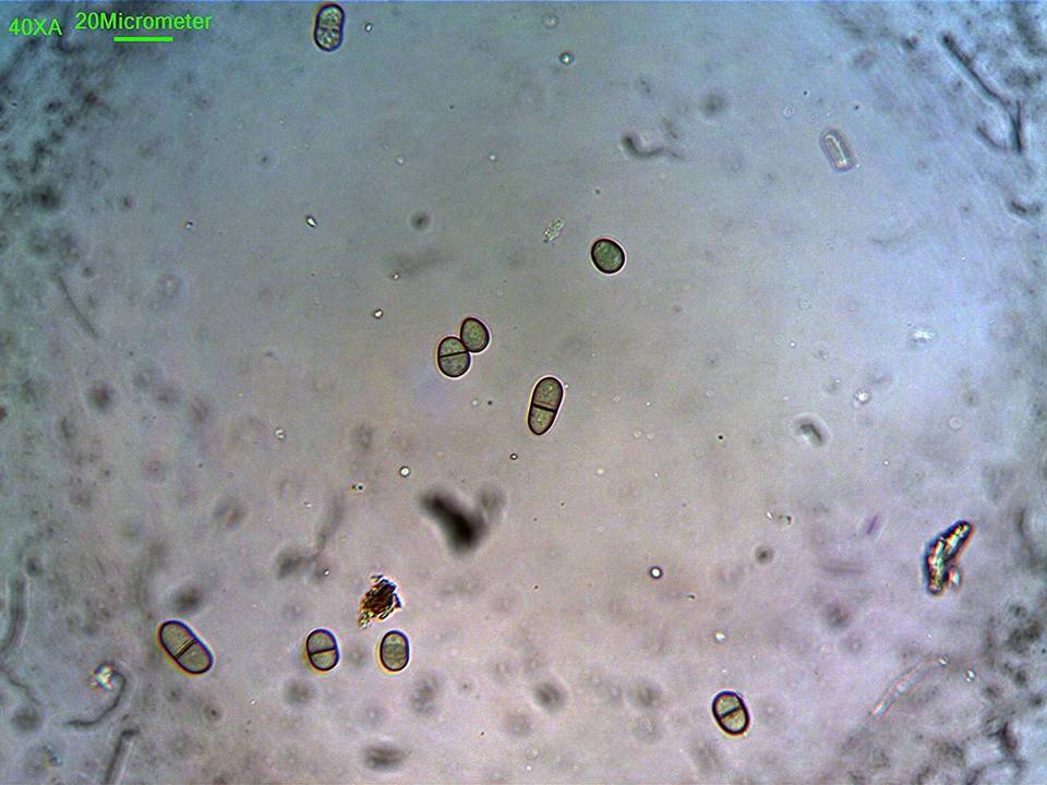 Paradidymobotryum image