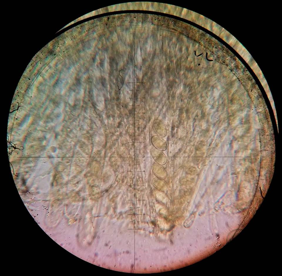 Cheilymenia theleboloides image