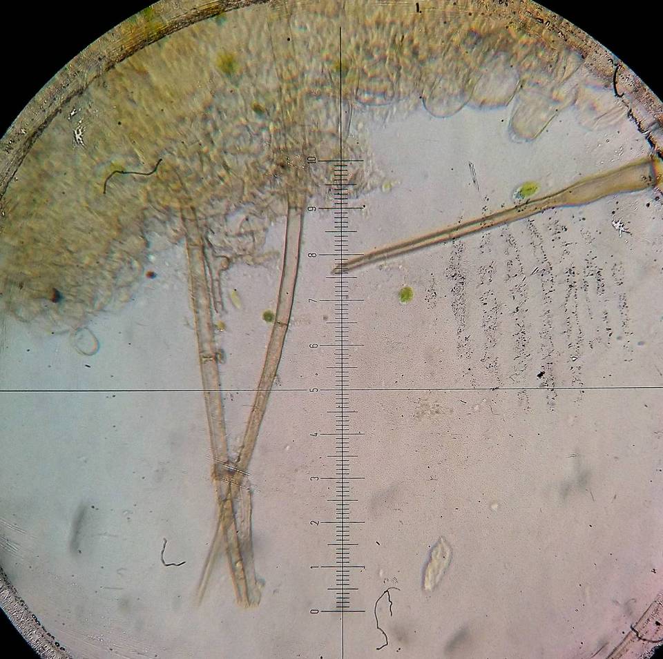 Cheilymenia theleboloides image