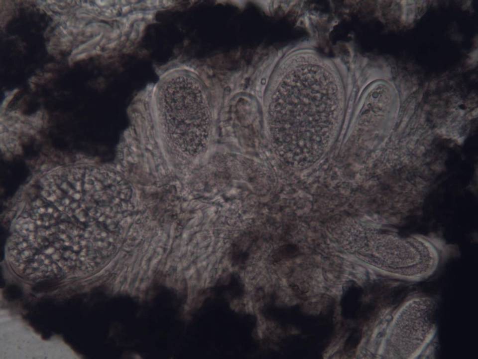 Lasallia hispanica image