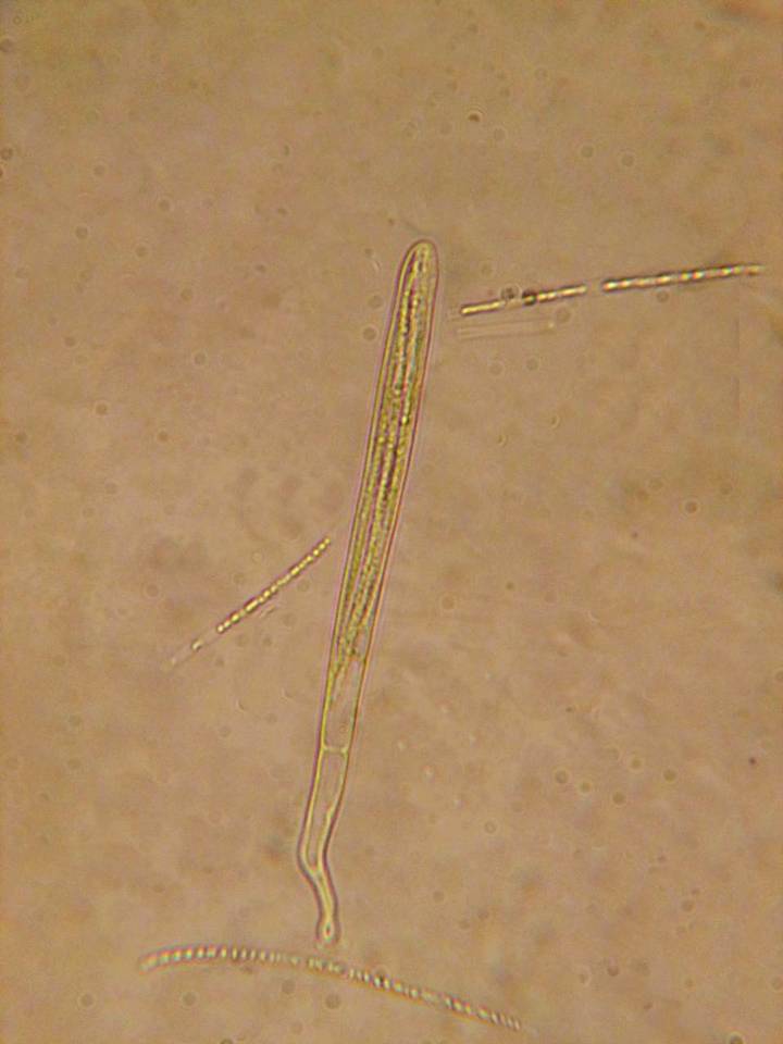 Lophodermium rubicola image