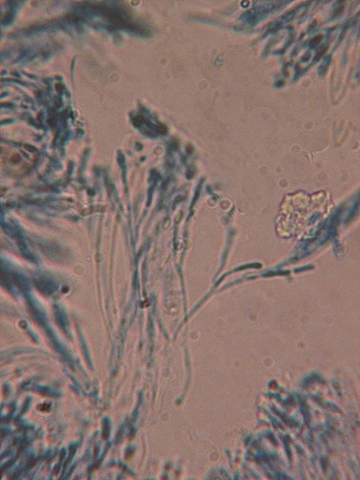 Micropeziza cornea image