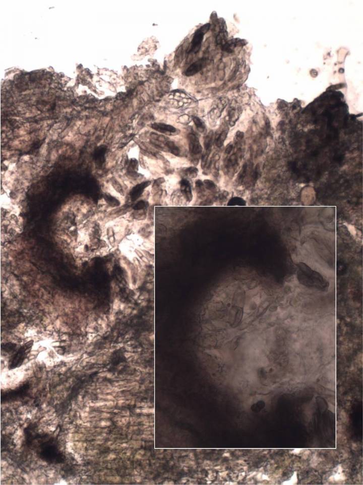 Melaspilea diplasiospora image