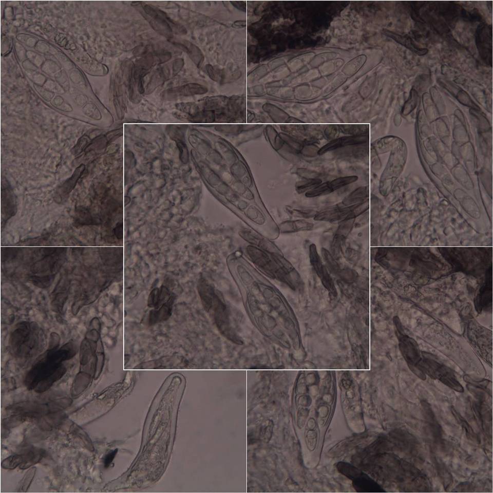 Melaspilea diplasiospora image