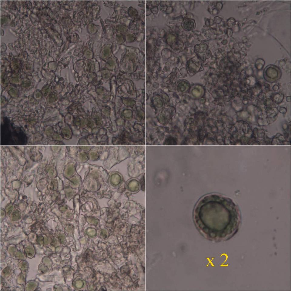 Porina leptospora image