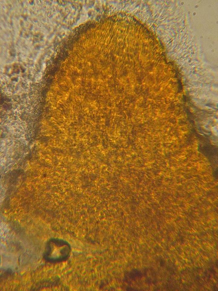 Nectria magnusiana image