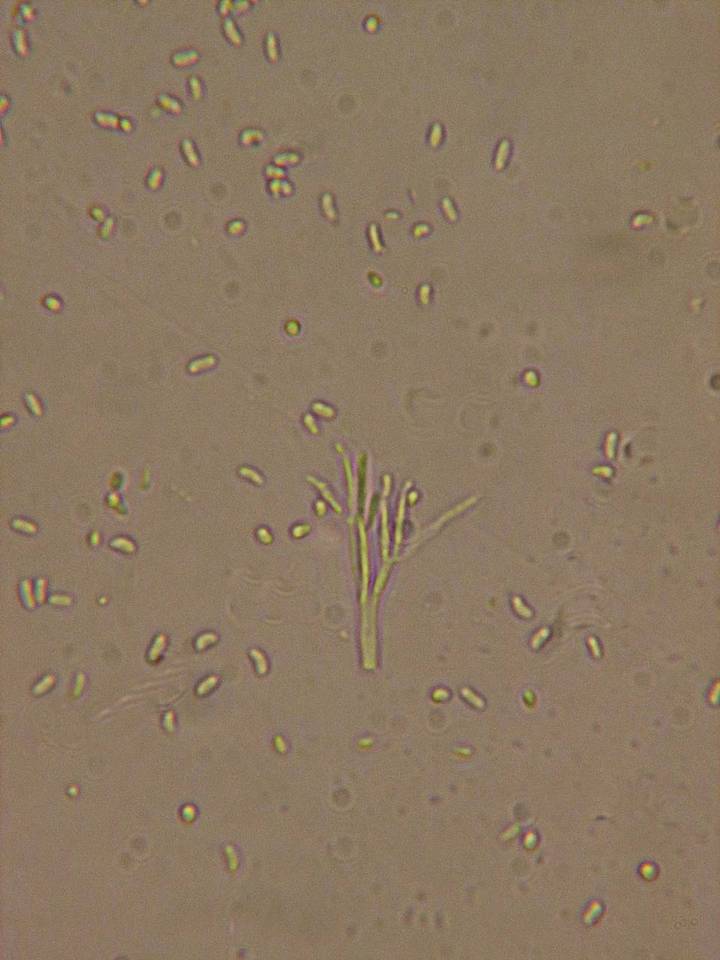 Nectria magnusiana image