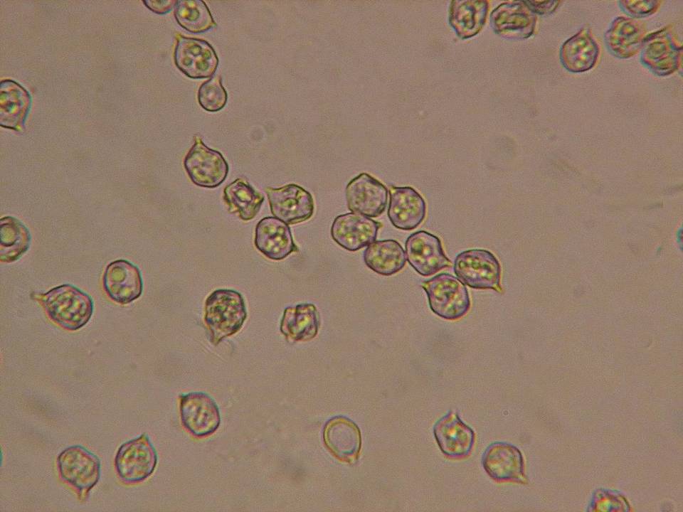 Nolanea pusillipapillata image
