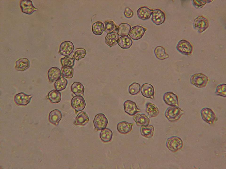 Nolanea pusillipapillata image