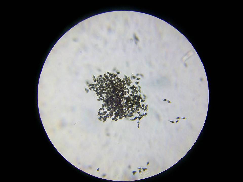 Pestalotiopsis microspora image