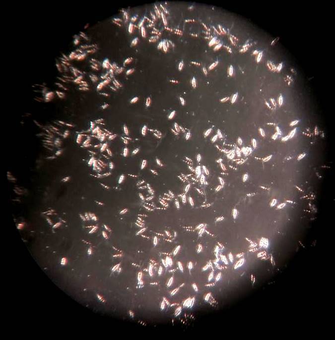 Pestalotiopsis image
