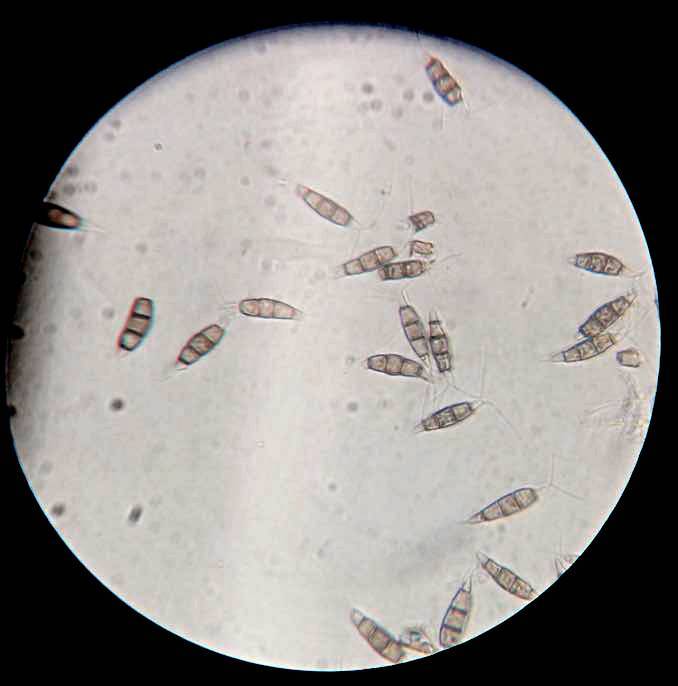 Pestalotiopsis image