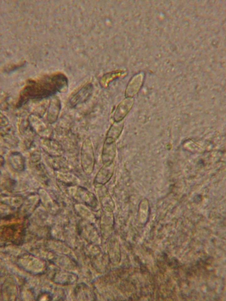 Rutstroemia calopus image