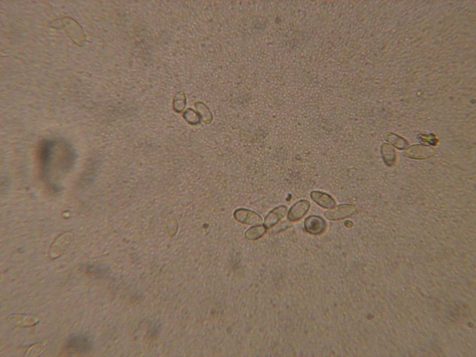 Rutstroemia calopus image