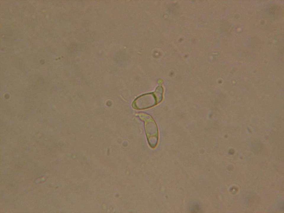 Rutstroemia calopus image