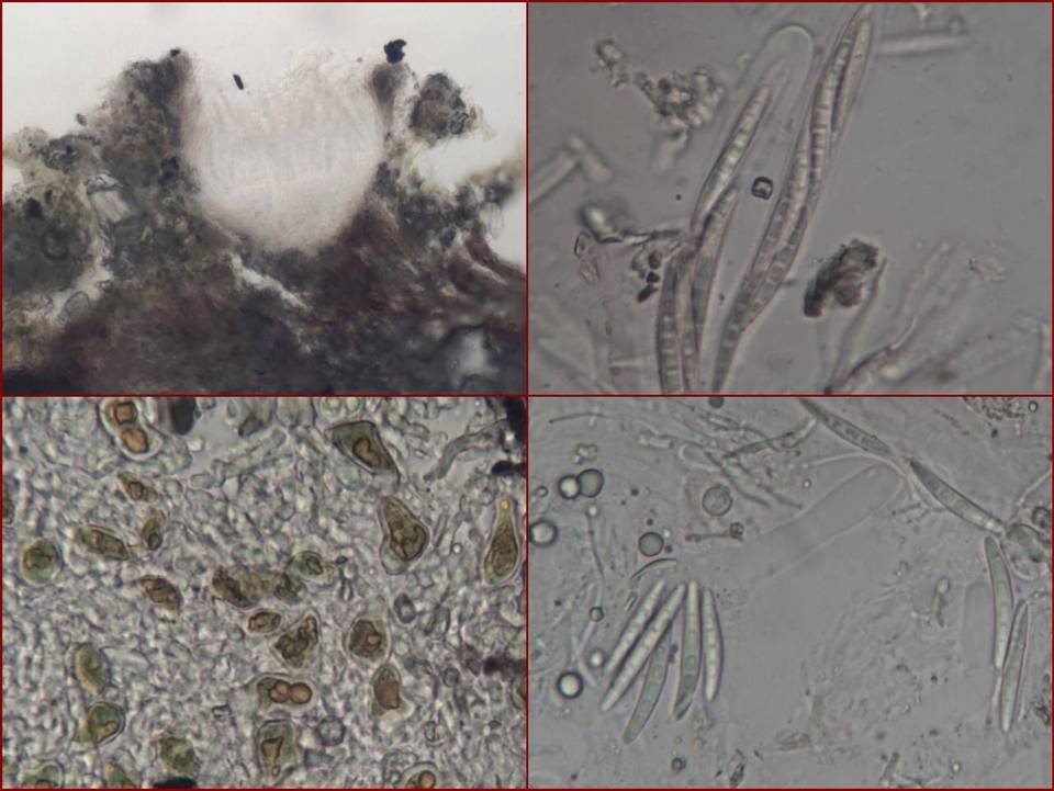 Enterographa hutchinsiae image