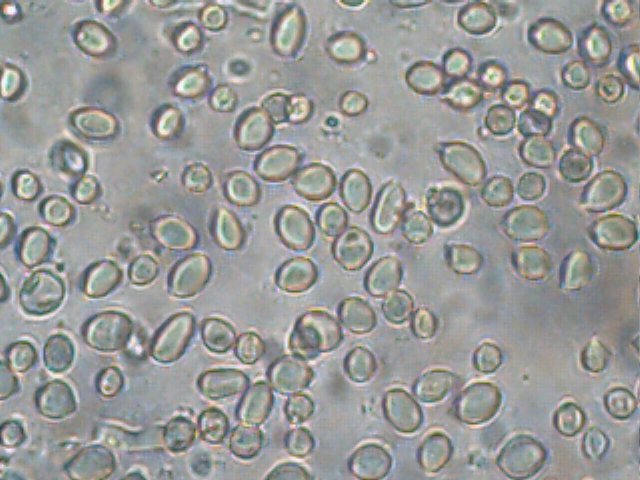 Schenella image