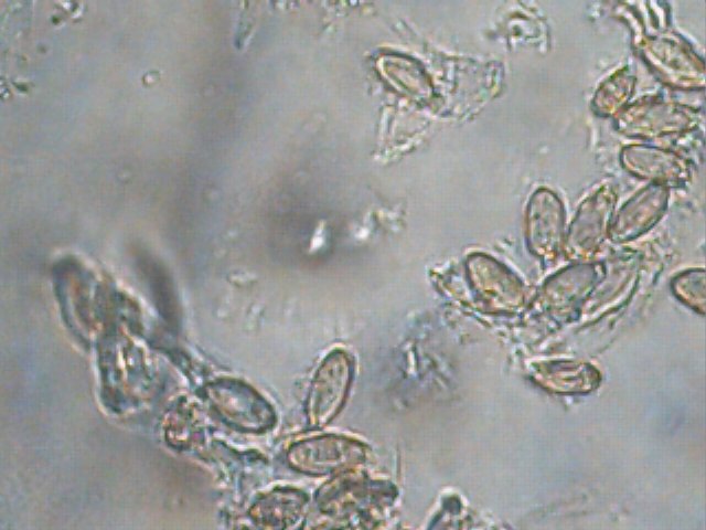 Hysterangium nephriticum image
