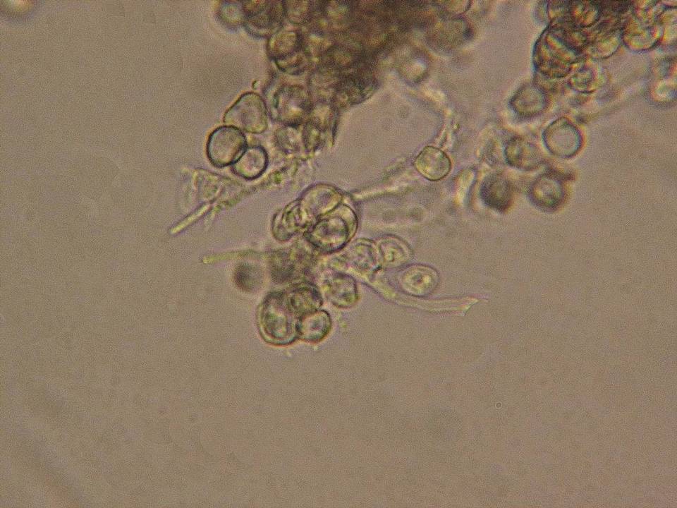 Dothiora dothideoides image