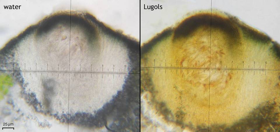 Cercidospora lobothalliae image