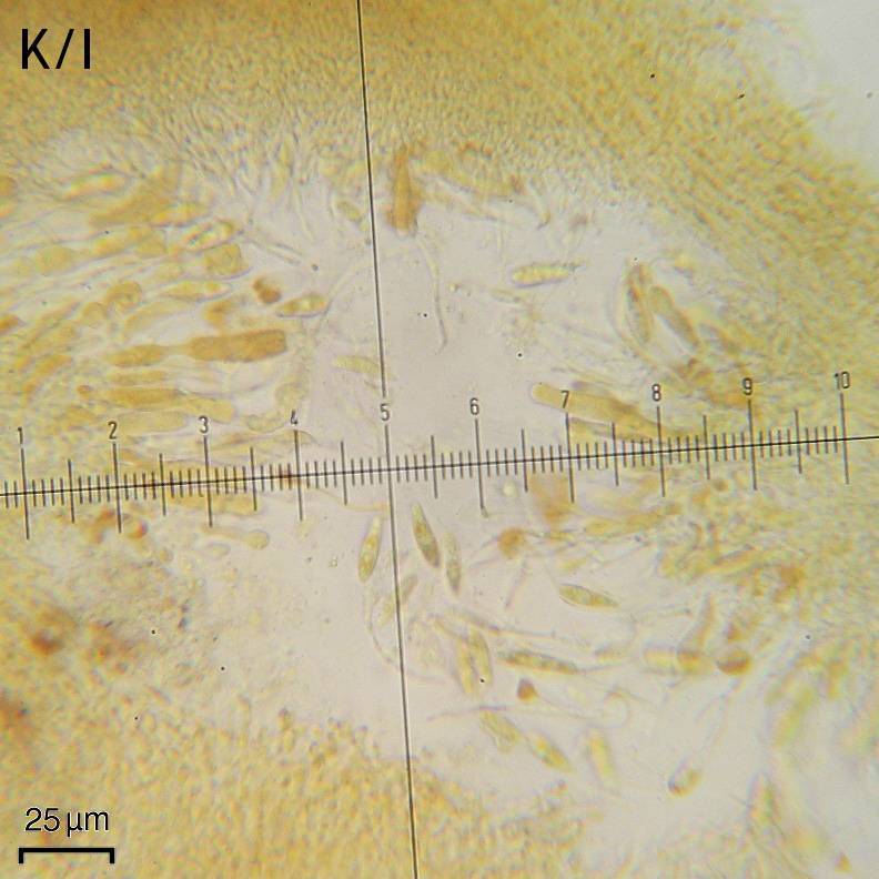Cercidospora image