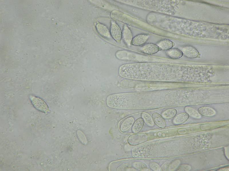 Peziza obtusapiculata image