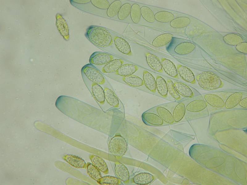 Peziza obtusapiculata image