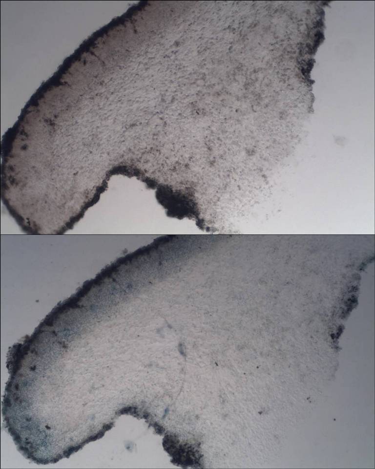 Protoblastenia cyclospora image