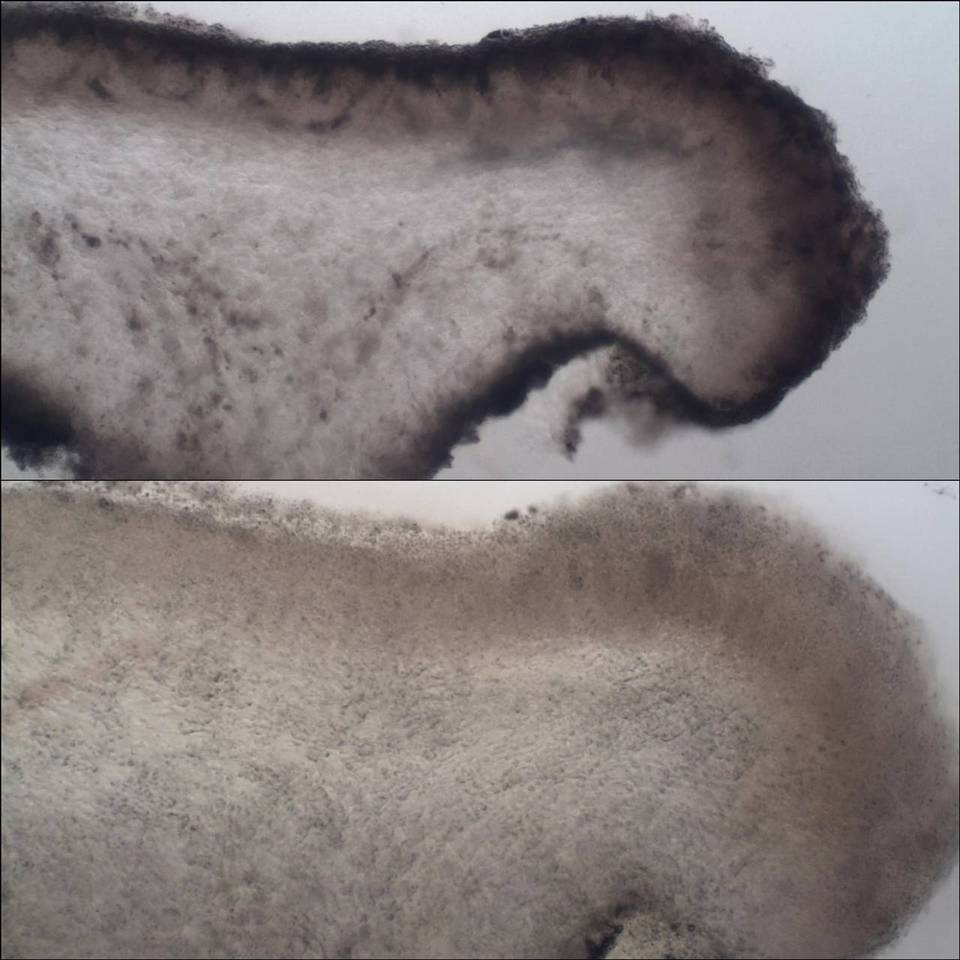 Protoblastenia cyclospora image