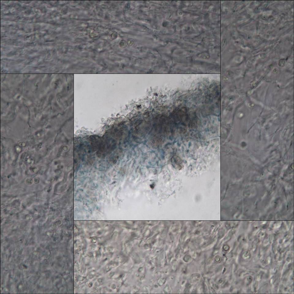 Protoblastenia cyclospora image