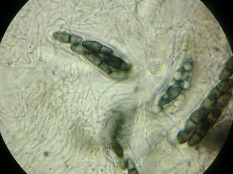Kirschsteiniothelia aethiops image