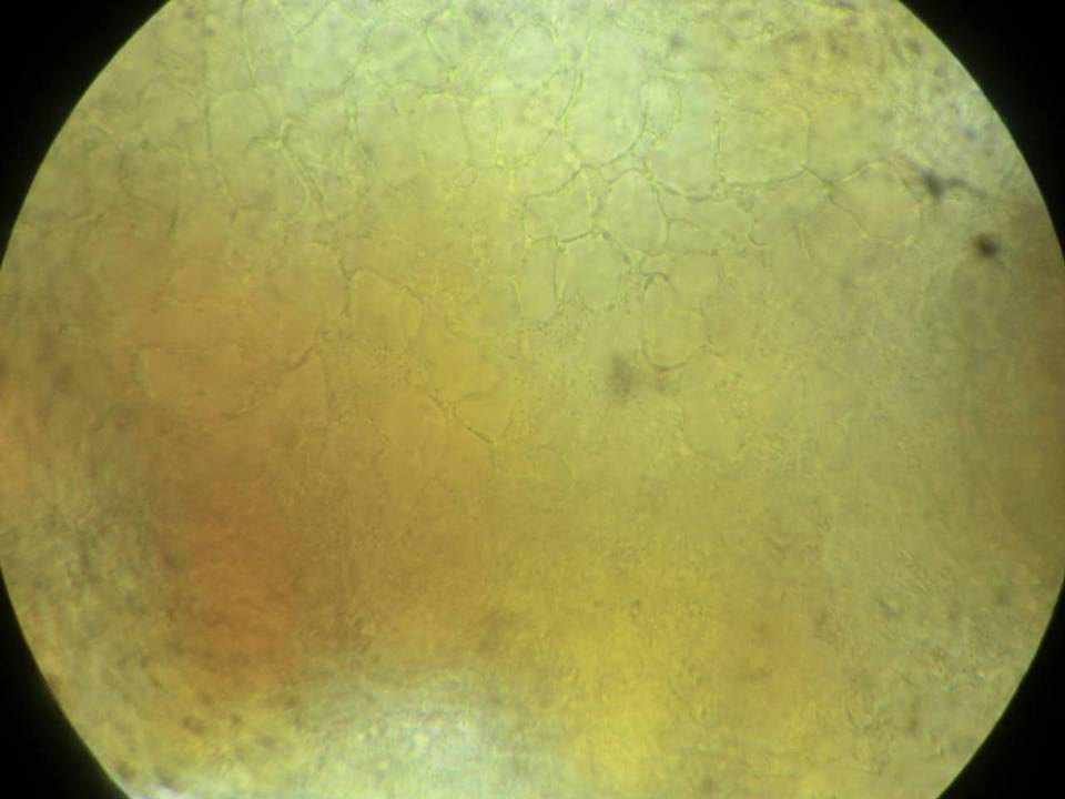 Leptosphaeria fuscella image