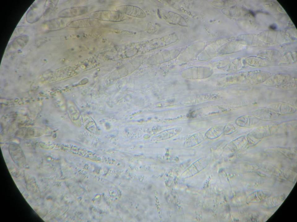 Leptosphaeria fuscella image
