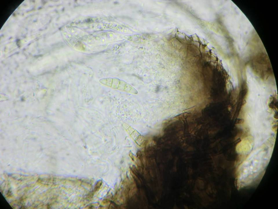 Phaeosphaeria mounceae image