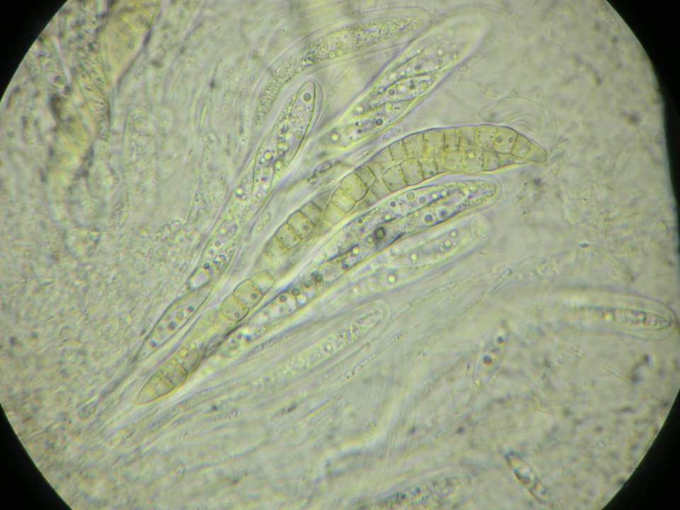 Phaeosphaeria mounceae image