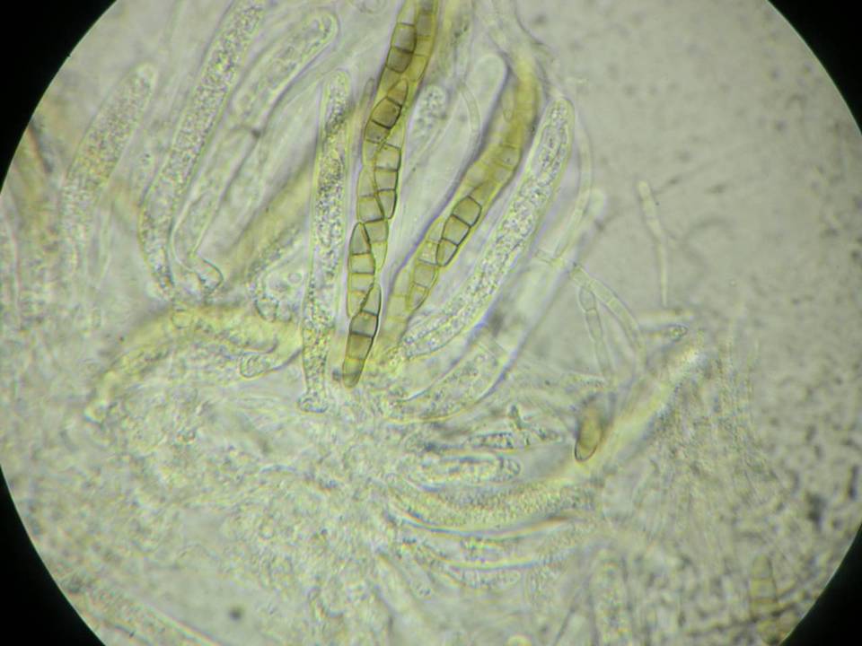 Leptosphaeria haematites image