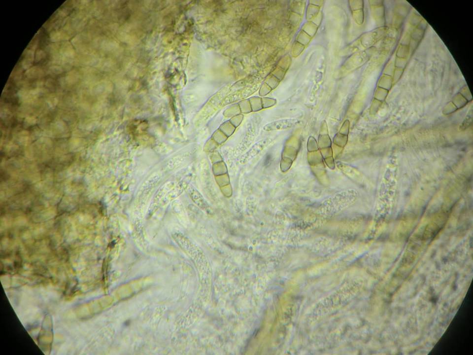Leptosphaeria haematites image