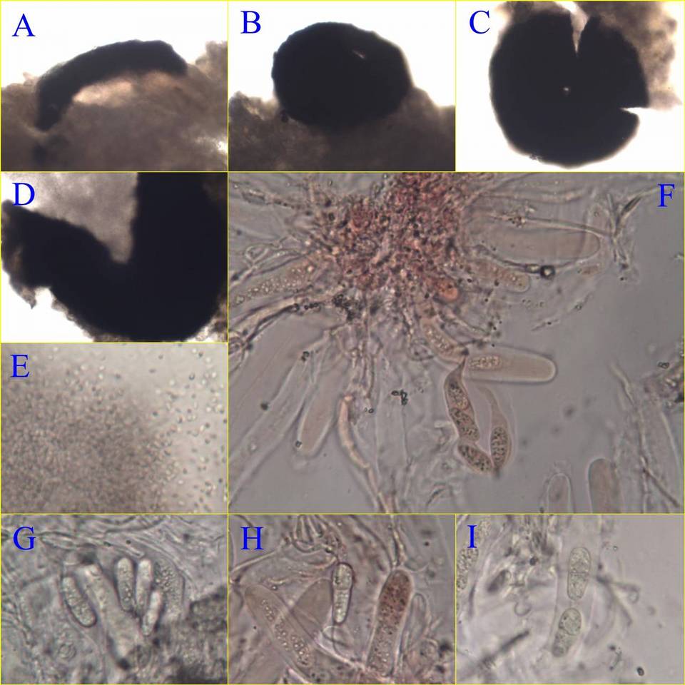 Collemopsidium image