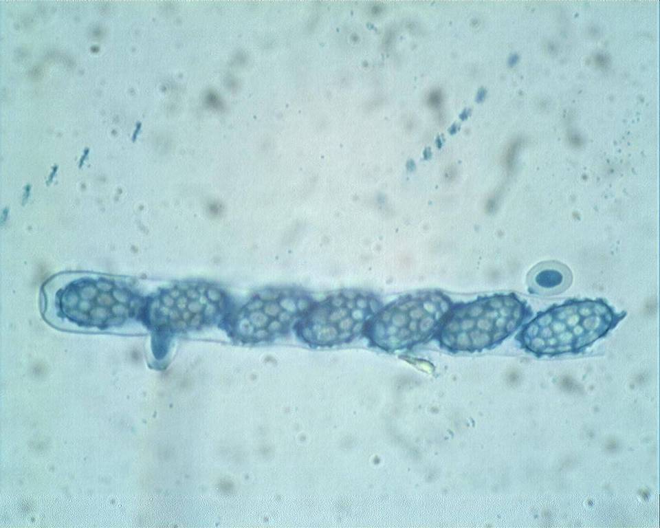 Melastiza cornubiensis image
