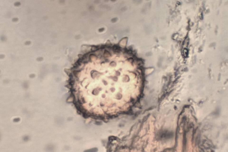 Scutellinia legaliae image