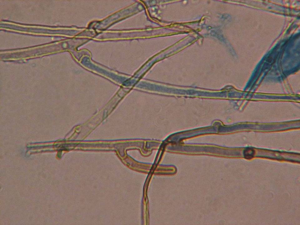 Phlebia subulata image