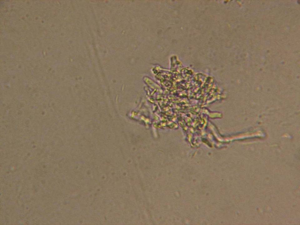 Skeletocutis nivea image